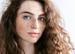 The CO2 Treatment to Reverse Sun Damage • Lynton Lasers