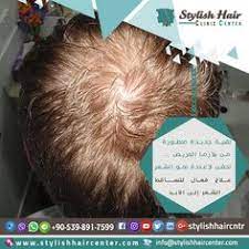 نتميز بخبرة حصرية في زراعة الشعر علاج كل مشاكل الشعر باحدث تقنيات الطب من الميزوثيرابي والبلازما الأمريكية نهتم بأدق التفاصيل وبدون اي اثار Movie Posters Movies