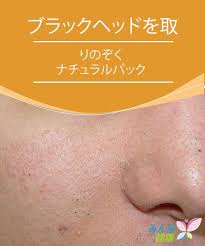ブラックヘッドを取りのぞく ナチュラルパック みんな健康 美容 スキンケア フェイスケア