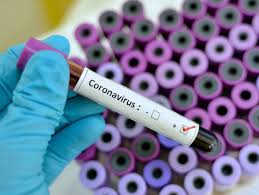 Check spelling or type a new query. Vicepresedintele SocietÄƒÅ£ii Romane De Epidemiologie SpulberÄƒ Temerile Coronavirusul È™i A Redus Rata De Transmitere Focustim