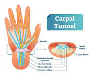 Image of Carpal tunnel anatomy