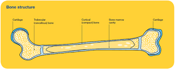 You do not have bone cancer. Primary Bone Cancer Overview Cancer Council Victoria