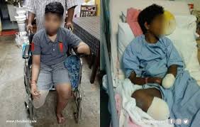 Ward doctor makes a decision without asking his boss, doctors are hard to be contacted, poor service. Ampang Hospital Hit With Negligence Suit After Teen Undergoes 4 Amputations Malaysia The Vibes