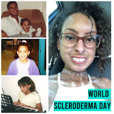 Scleroderma Strong