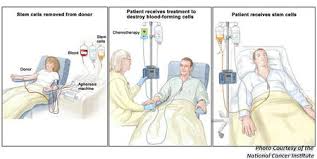 Pin On Leukemia Treatments Information And Survivors