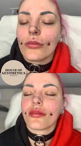 HouseofAestheticsclinic added a...