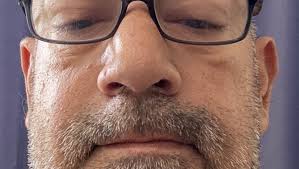 Fundraiser by Edwin Mojica : Support Edwin Mojica's Fight Against Kidney  Failure