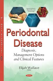 Periodontal Disease Diagnosis Management Options And Clinical Features Nova Science Publishers