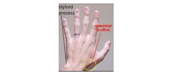 Anatomy Shoulder And Upper Limb Hand Anatomical Snuff Box Article The anatomical snuffbox (also known as the radial fossa), is a triangular depression found on the lateral aspect of the dorsum of the hand. hand anatomical snuff box