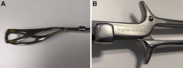 When the baby's head was very low and on view. Intrapartum Ultrasound During Rotational Forceps Delivery A Novel Tool For Safety Quality Control And Teaching American Journal Of Obstetrics Gynecology