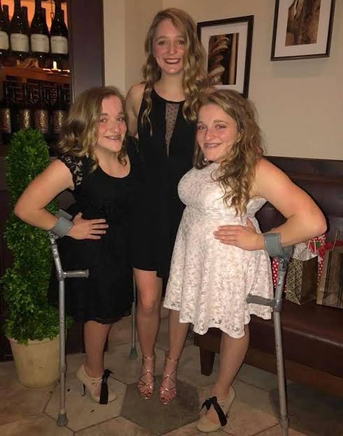 Formerly Conjoined Sisters Celebrate 18th Birthdays