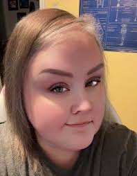 During chemo, did you prefer wearing a WIG or a SCARF?