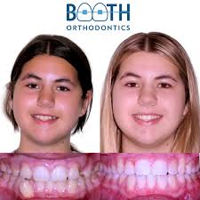 Booth Orthodontics