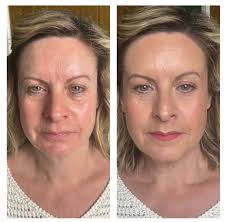 Albrighton (Non Commercial) Community Group