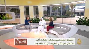 حل مشكله انخفاظ الكنب من كثر الجلوس