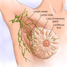 There are three main categories of surgical treatment for breast cancer: Breast Surgery Adelaide Surgical Options For The Treatment Of Breast Cancer Breast Cancer Endocrine And General Surgery Dr Andrew Kiu