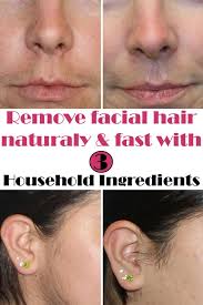 Hair can be removed with a depilatory (a liquid or cream preparation that removes unwanted hair) because removing hairs chemically does not trigger the problem the way shaving does, although the. Natural Way To Remove Facial Hair Style Idea Treat Ingrown Hair Ingrown Hair Female Facial Hair