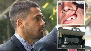 Bashing victim says AFL star's penalty is too light