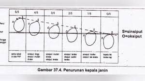 Partograf partograf adalah alat bantu yang digunakan selama persalinan. 10 05 Mb Cara Pengisian Partograf Download Lagu Mp3 Gratis Mp3 Dragon