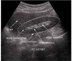 The medical history or (medical) case history of a patient is information gained by a physician by genitourinary history of polyuria (excessive urination) due to diabetes, renal disease, unknown cause, etc. A Decision Support System For Classification Of Normal And Medical Renal Disease Using Ultrasound Images A Decision Support System For Medical Renal Diseases Semantic Scholar