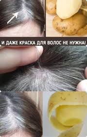 какие маски для волос можно сделать в домашних условиях Kak Prosto Izbavitsya Ot Sediny V Domashnih Usloviyah Lekarstva Dlya Volos Maski Dlya Volos Shampun Dlya Rosta Volos