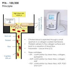 Image result for Platelet Function Closure Time