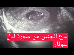 الفرق بين الولد والبنت في صورة السونار مقارنه Youtube