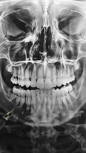 Image result for Skull XRay