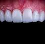 Dentes Perfeitos (Dentistas/Implante Dental/Ortodontia/Harmonização Facial/Prótese em Rocha Miranda, Rio de Janeiro) from prorir.com.br