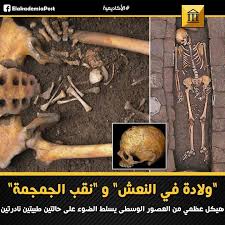 ولادة في النعش و نقب الجمجمة هيكل عظمي من العصور الوسطى يسلط الضوء على حالتين طبيتين نادرتين وفقا لتقرير تم نشره في World Neuros Movie Posters Art Poster