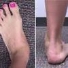 Jul 25, 2017 · in humans, the foot is one of the most complex structures in the body. 1