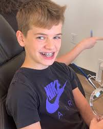 Jace is our newest braceface!! #jacedenver #braceface  #schaaffamilyadventures2022