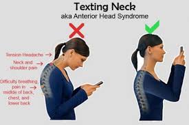 Improving your posture is like loosening up one side of an uneven tent so you can tighten the other side to even it out. if you want to learn how to fix your posture then this is the order you should go. The Ultimate Exercises To Improve Posture Simple And Effective