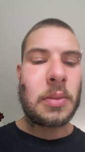 Helping my battle to survive