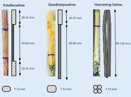 Bandverletzungen des knies entstehen häufig durch rotationstraumen bei sportlicher aktivität. Abb 3 8 Gangige Transplantate Beim Vorderen Kreuzbandersatz A Download Scientific Diagram