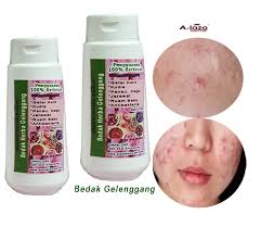 Bedak debu Gelenggang untuk panau kurap kudis gatal cagu ruam kulit kering  bisa air jerawat dan pelbagai keguaan untuk penyakit kulit. Bedak Powder  Herba Gelenggang