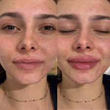 TOP 10 BEST Electrolysis Hair Removal near Valley Village, Los Angeles, CA 