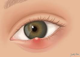 Image result for Blepharis inflata