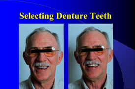 Selecting Denture Teeth Ppt Video Online Download