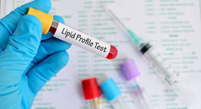 Health Checkups Tips