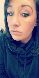 Accident Prone Boxer Dogs and Their High Energy Levels