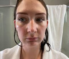 Can someone tell me how to get rid of these lines? : r/30PlusSkinCare