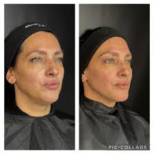 Reel by Dra Sofia Brodsky (@sb.medicinaestetica) · February 6, 2024