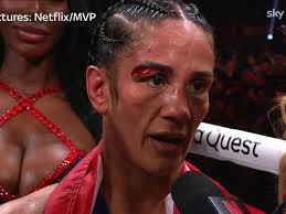 Amanda Serrano has claimed that Katie Taylor intentionally headbutt her in  their undisputed super lightweight championship fight. Paul vs. Tyson is  now available to watch globally