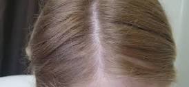 Can someone help match a hair dye box color to my roots? : r ...