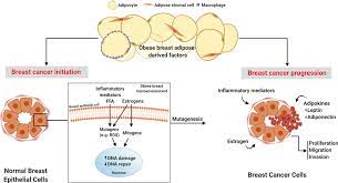 Histologically, the dermal lymphatic invasion is pathognomonic of inflammatory breast cancer but. Frontiers Obese Adipose Tissue As A Driver Of Breast Cancer Growth And Development Update And Emerging Evidence Oncology