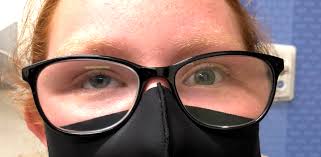 Image result for Eye Deviation