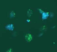 Start with your 5 senses. Proteomics Analysis Of Cells In Whole Saliva From Oral Cancer Patients Via Value Added Three Dimensional Peptide Fractionation And Tandem Mass Spectrometry Molecular Cellular Proteomics
