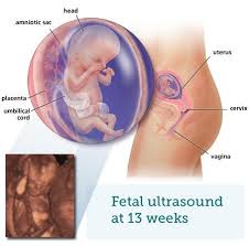 These two terms simply define different phases of development. Fetal Ultrasound 3 Months Babycentre Uk