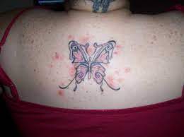 Tattoo Rash Symptoms Causes Treatment Authoritytattoo